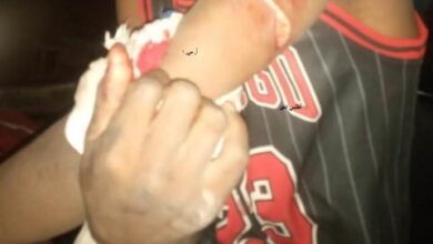 صورة دورية من الحرس الوطني تلقي القبض على صاحب سوابق مصاب