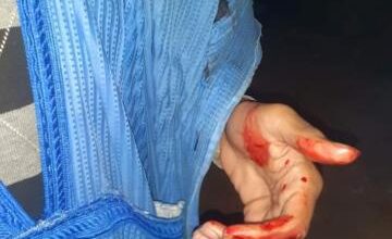صورة تعرض صحفي لإعتداء بالسلاح الابيض