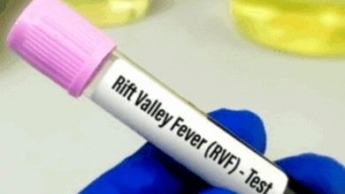 صورة السنغال: 18 وفاة بالوادي المتصدع وست إصابات بجدري القردة